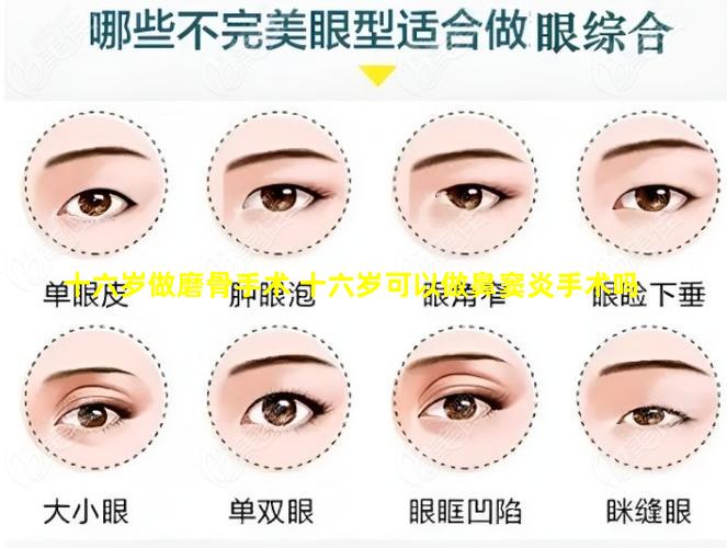 十六岁做磨骨手术 十六岁可以做鼻窦炎手术吗
